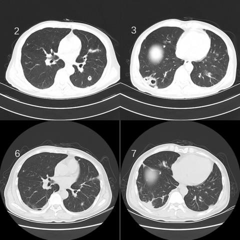 《空洞骑士》丝之歌壳囊获取攻略：揭秘隐藏位置与高效获取技巧