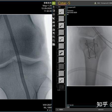 帧率翻倍秘籍！《辐射4》低配福音贴图优化Mod大揭秘