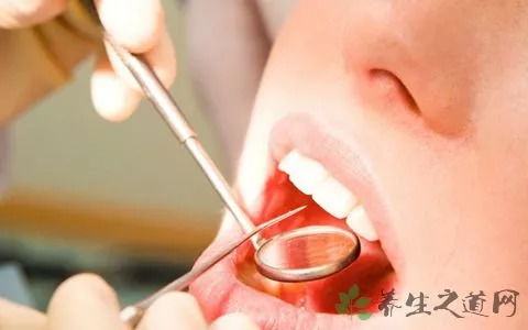 冻土豆崩牙后必须拔吗？2026口腔急诊医生揭秘3种拔牙类型与保命护理法则